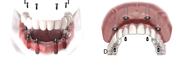 1724744908112708.png 未标题11111-1.png